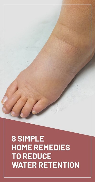 8 Simple Home Remedies to Reduce Water Retention
