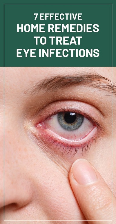 7 Effective Home Remedies To Treat Eye Infections