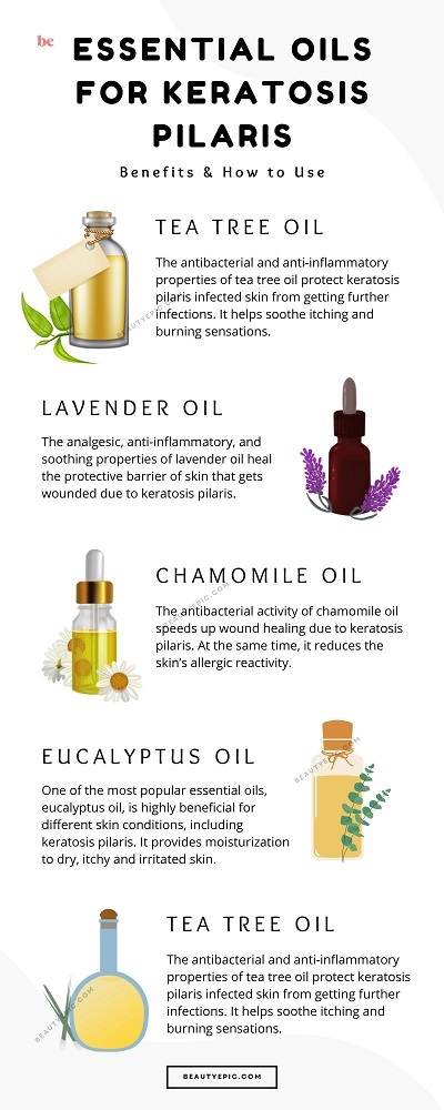 Essential Oils For Keratosis Pilaris