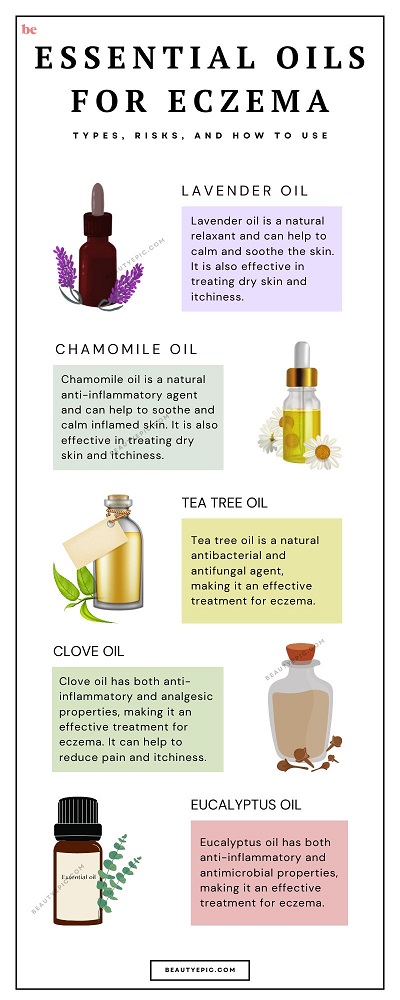 essential oils for eczema