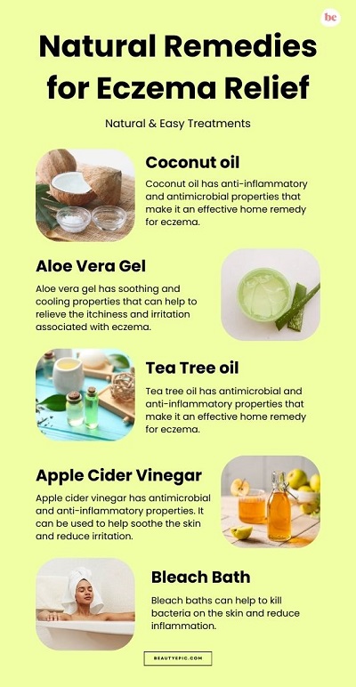 Natural Remedies for Eczema Relief