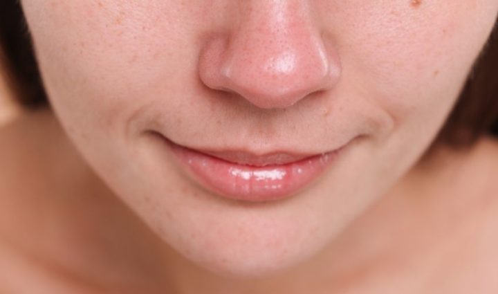 Reduce Blackheads on the Face
