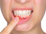 What Causes Itchy Gums Inbetween Teeth