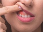 what causes Gum Growing Between Teeth & How to Correct it
