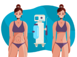 Laser Lipo Vs Coolsculpting What is the Difference