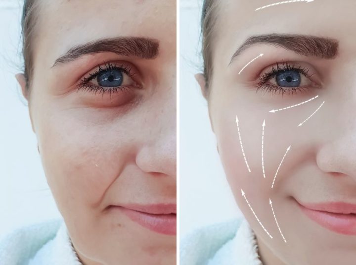 High Cheekbones Vs Low Cheekbones: Which One Attractive?