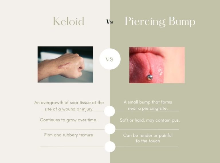 Piercing Bump vs keloid Causes, Symptoms, and Treatment