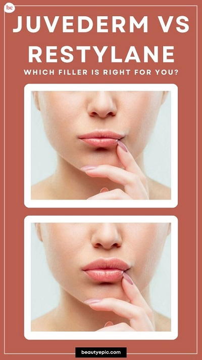 Juvederm vs. Restylane