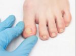 How Long Does It Take for a Toenail to Grow Back
