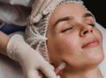 Microneedling Side Effectswho Should Not Have Microneedling Treatment