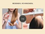 Redensyl Vs Minoxidil Which Is Better