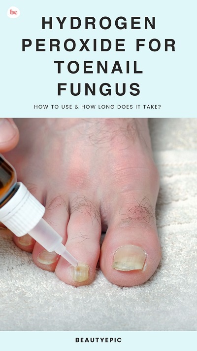 Hydrogen Peroxide for Toenail Fungus