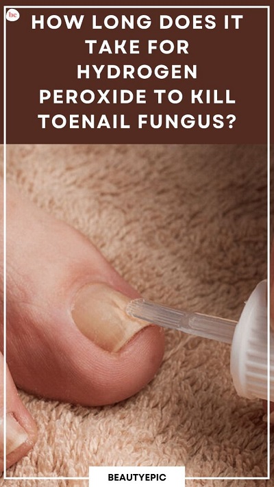 How Long Does It Take for Hydrogen Peroxide to Kill Toenail Fungus