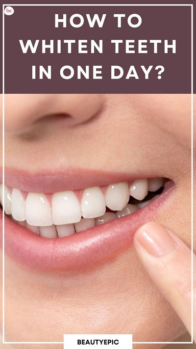 How to Get White Teeth in 1 Day