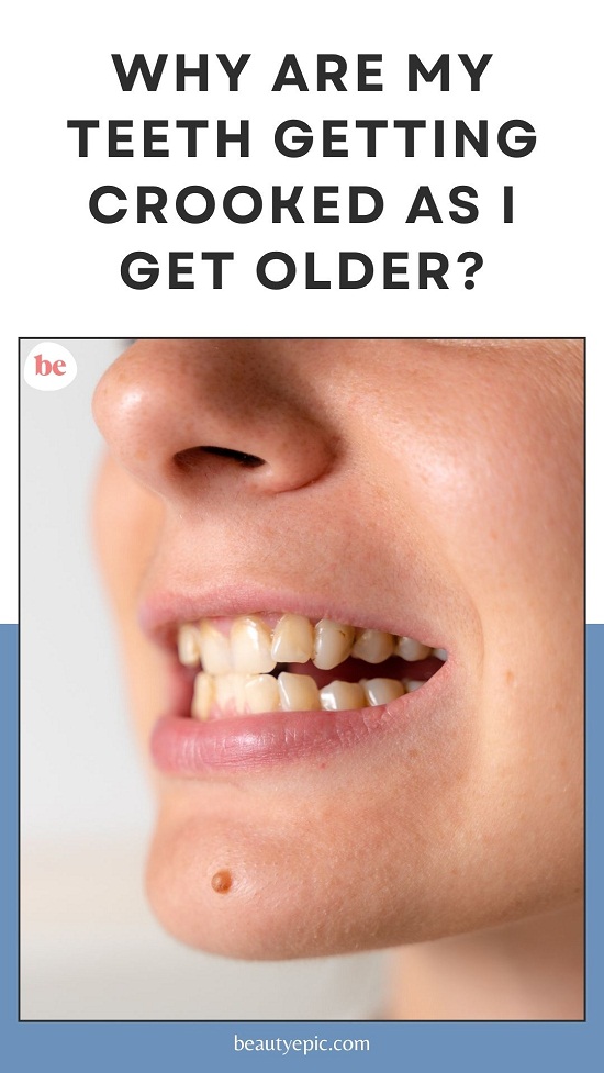Why Are My Teeth Getting Crooked as I Get Older