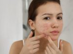 Best Face Wash for Rosacea