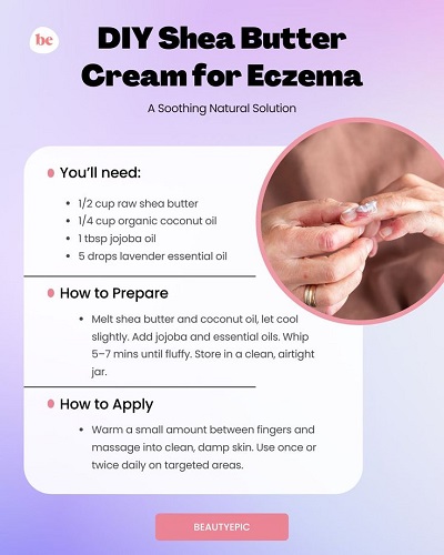 DIY Shea Butter Cream for Eczema