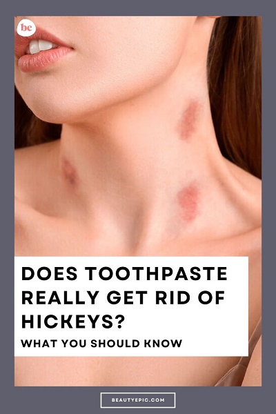 Does Toothpaste Really Get Rid of Hickeys