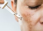 DIY Homemade Hyperpigmentation Cream for All Skin Types