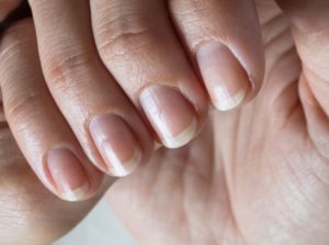 nails reveal health