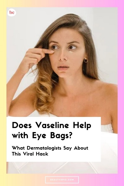 Does Vaseline Help with Eye Bags