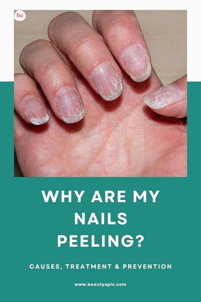 Why Are My Nails Peeling