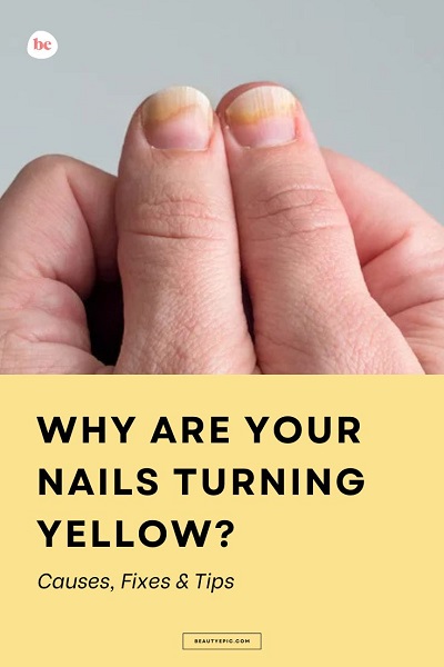 Why Are Your Nails Turning Yellow