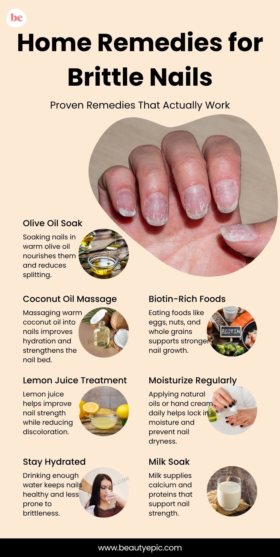 home remedies for Brittle nails