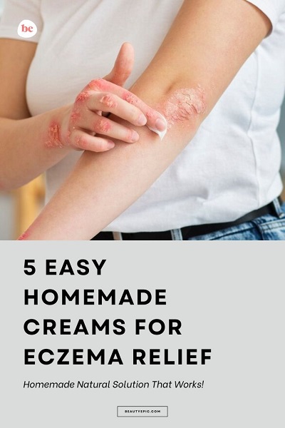 homemade creams for eczema