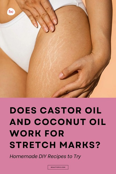 castor oil and coconut oil for stretch marks