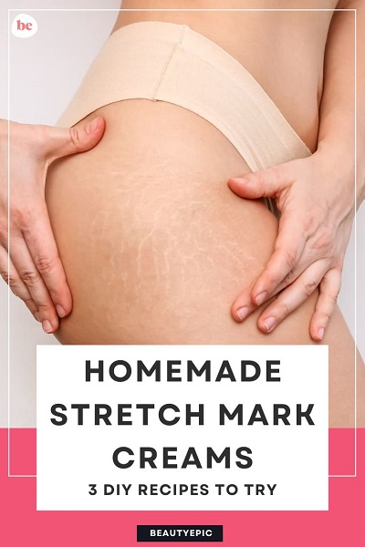 diy stretch mark cream