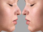 Can You Reshape Your Nose with Exercise Myths, Facts, and Natural Alternatives