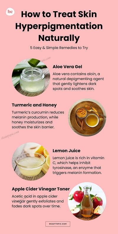 How to Treat Skin Hyperpigmentation Naturally