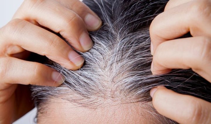 10 Home Remedies to Delay and Treat White Hair