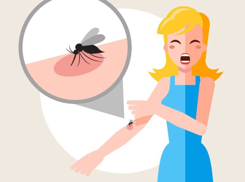 10 Best Home Remedies for Mosquito Bites That Are Safe and Effective