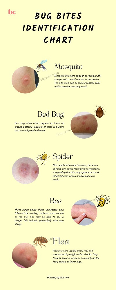 identifying bug bites and stings