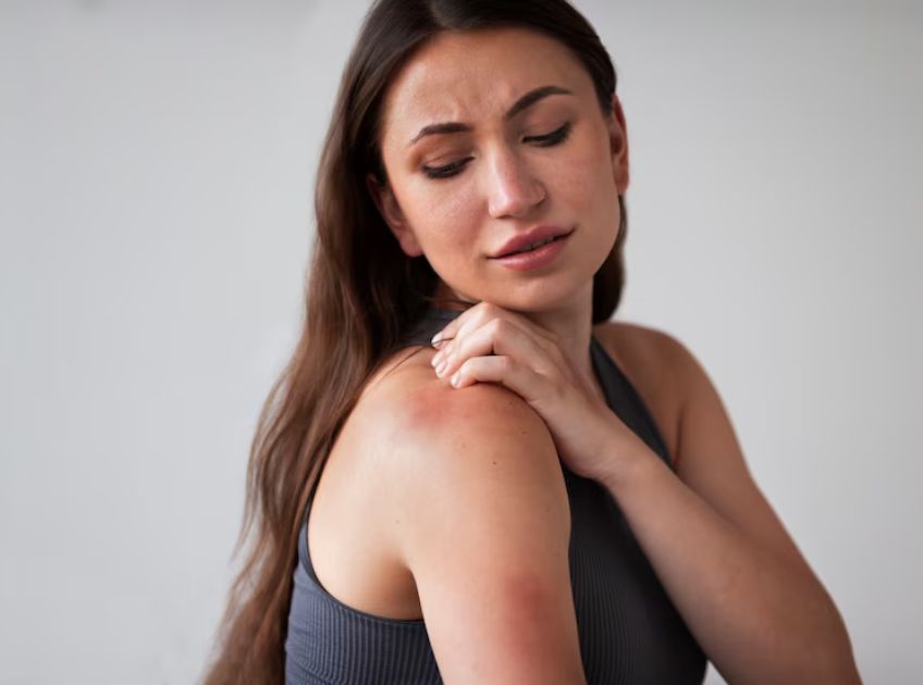 Can You Use Essential Oils for Bug Bites What the Research Says