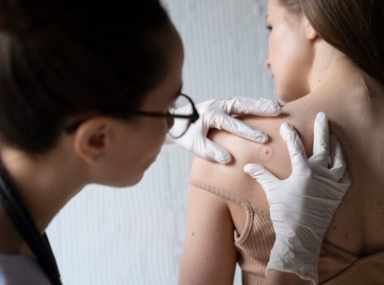 How Essential Oils Can Soothe Wasp Stings Fast?
