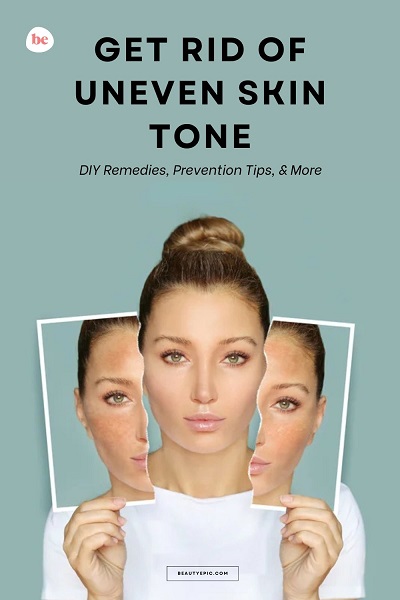 Get Rid Of Uneven Skin Tone