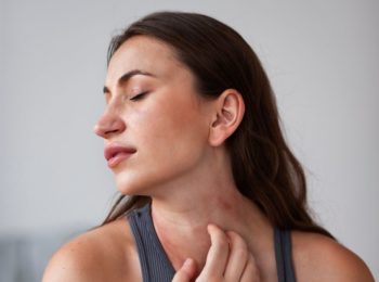 10 Effective Home Remedies for Heat Rash Relief