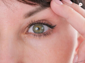 how to fix droopy eyelids without surgery
