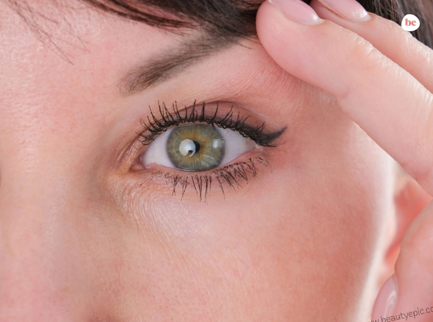 how to fix droopy eyelids without surgery