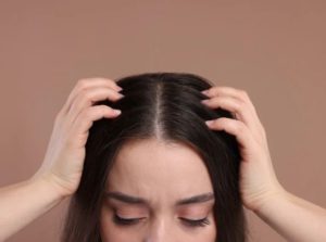 Scalp BuildUp Definition, Causes and How to Treat It