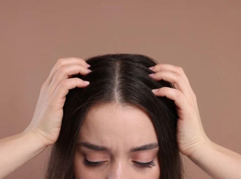 Scalp BuildUp: Definition, Causes and How to Treat It