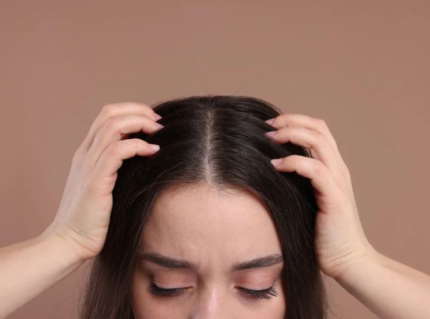 Scalp BuildUp Definition, Causes and How to Treat It