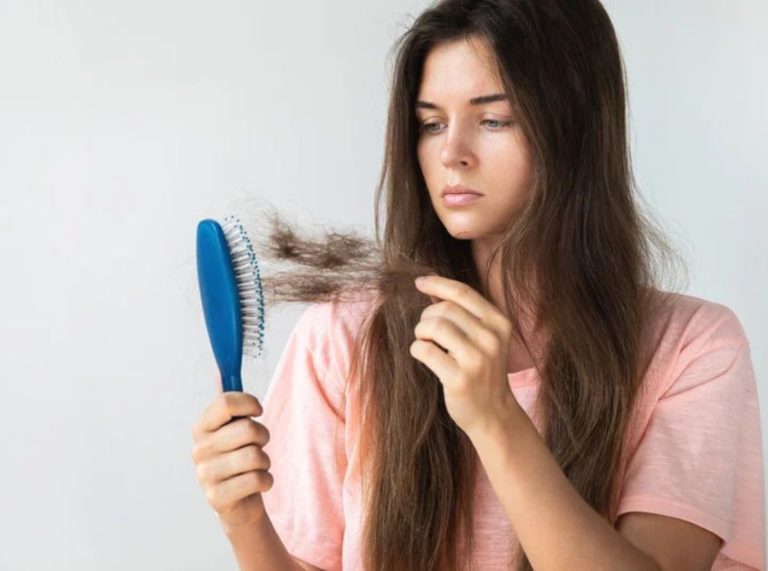 How to Control Excessive Hair Shedding: Causes, Solutions, and Expert Advice