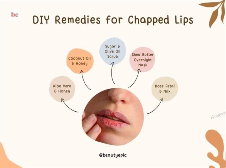 Home Remedies for Chapped Lips: 5 Natural DIY Treatments