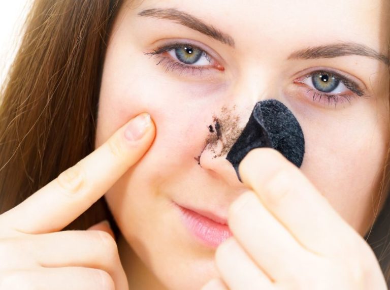 DIY Nose Strips to Remove Blackheads at Home