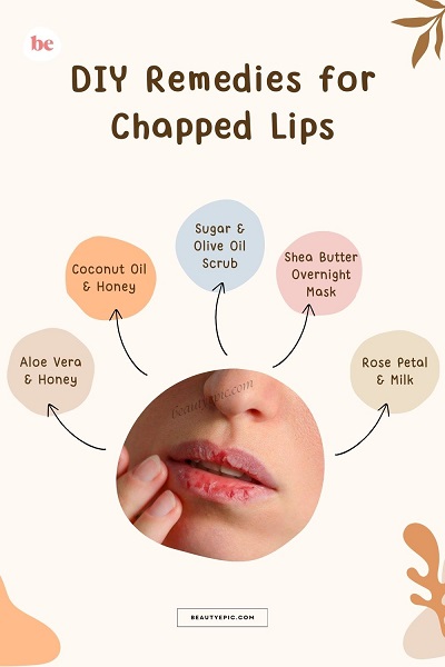 DIY Chapped Lips Remedies