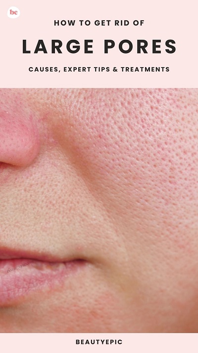 Large Pores